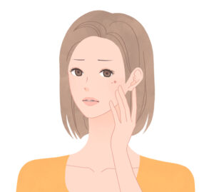 シミ治療の経過