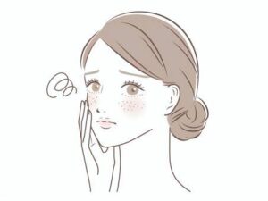 顔のシミ・脂漏性角化症の症例