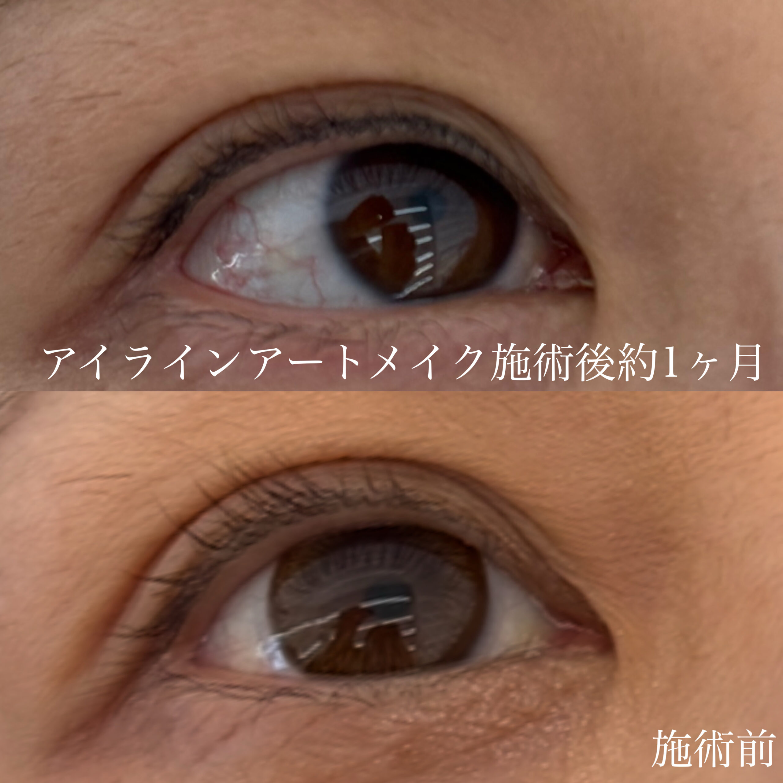 アイラインアートメイクの自然な仕上がり