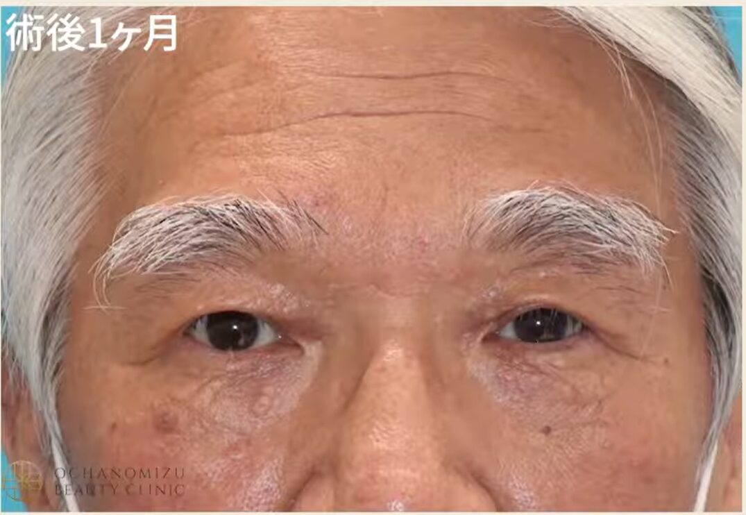 術後の変化2