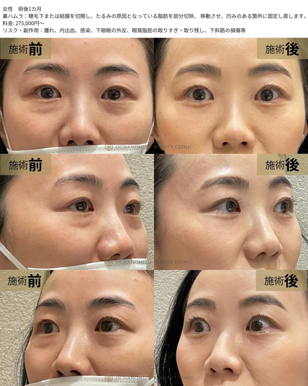 裏ハムラ