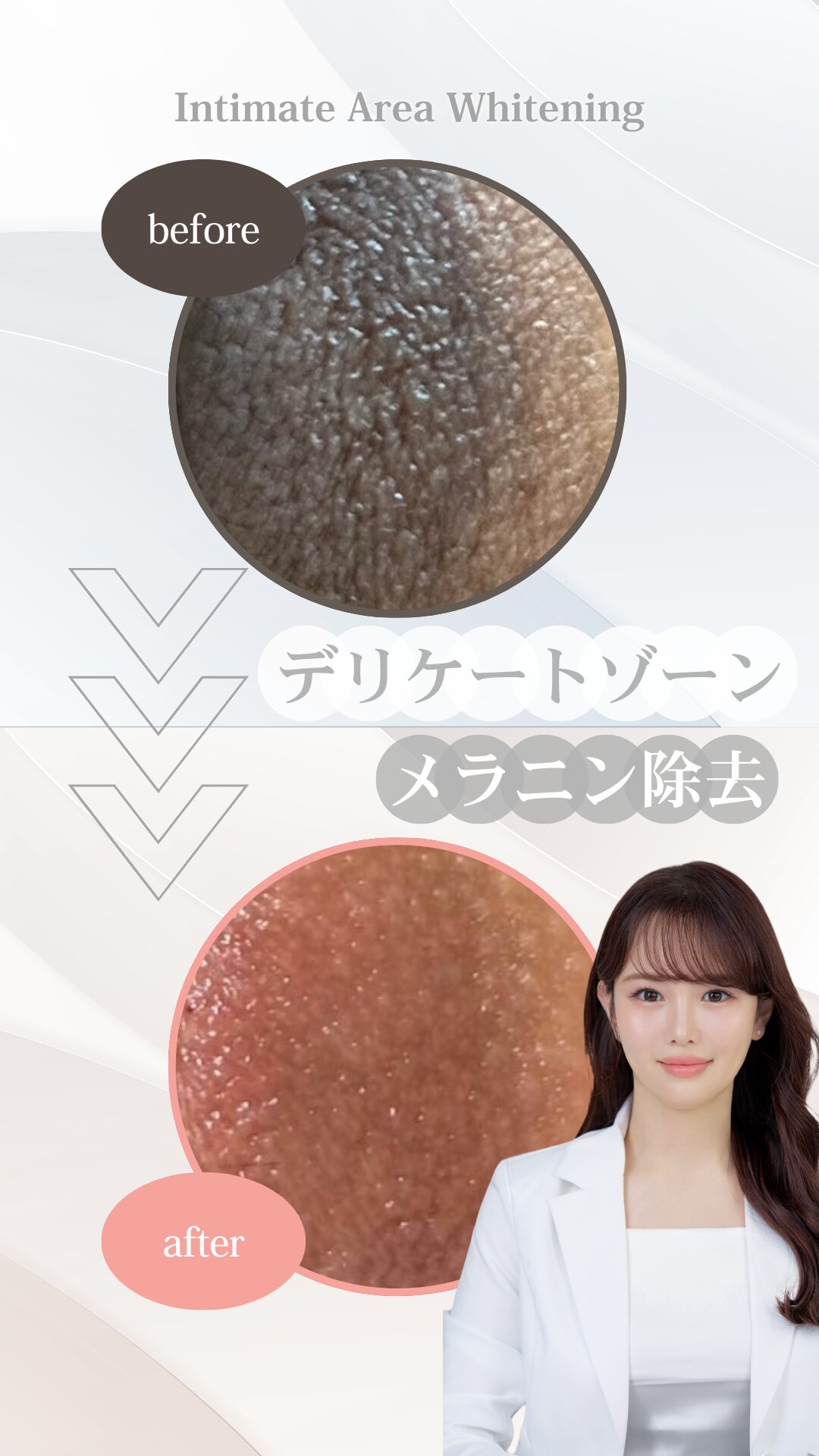 ROMA PINK くすみケア お茶の水美容形成クリニック