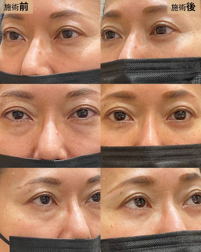 裏ハムラ